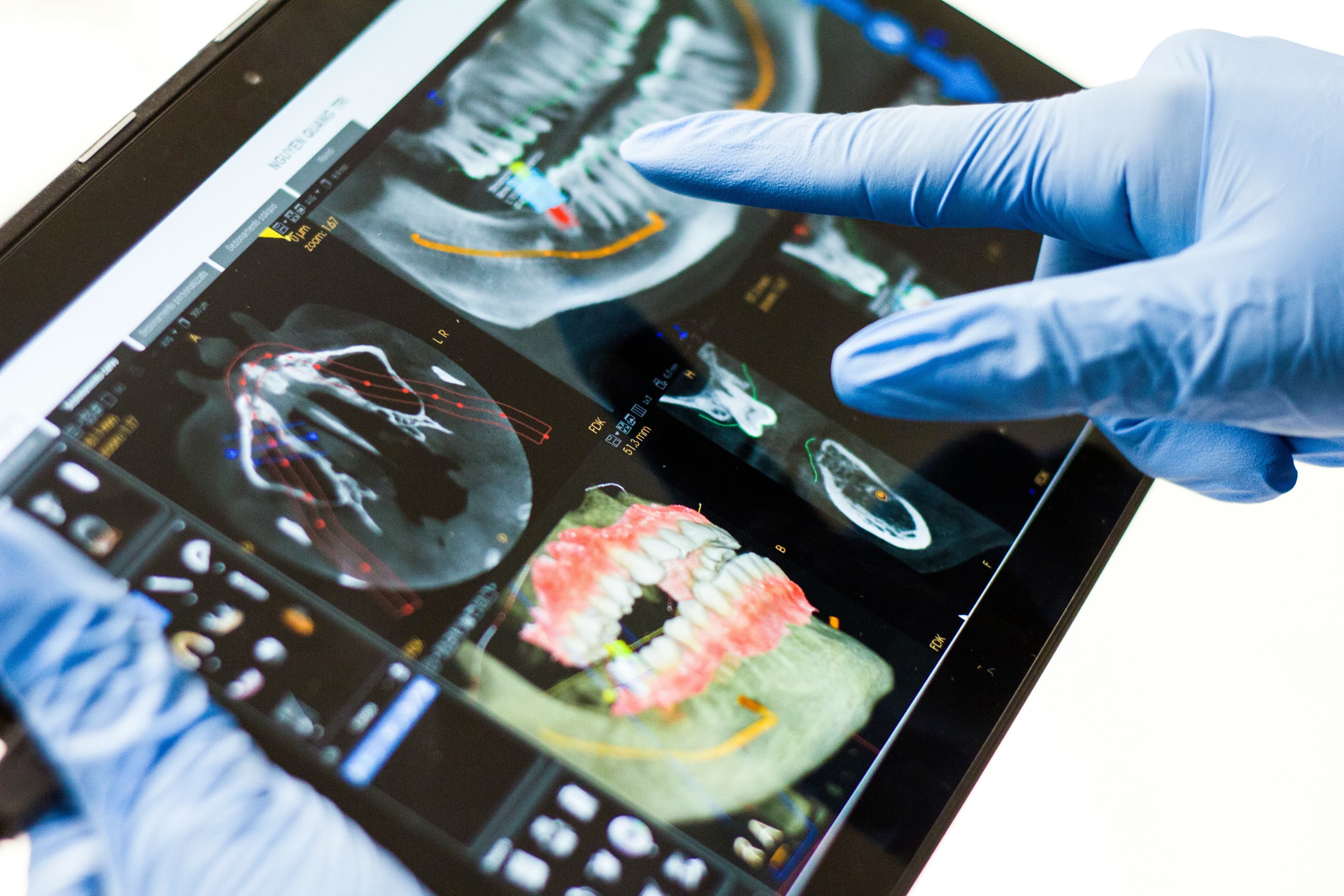 Advanced dental X-ray technology